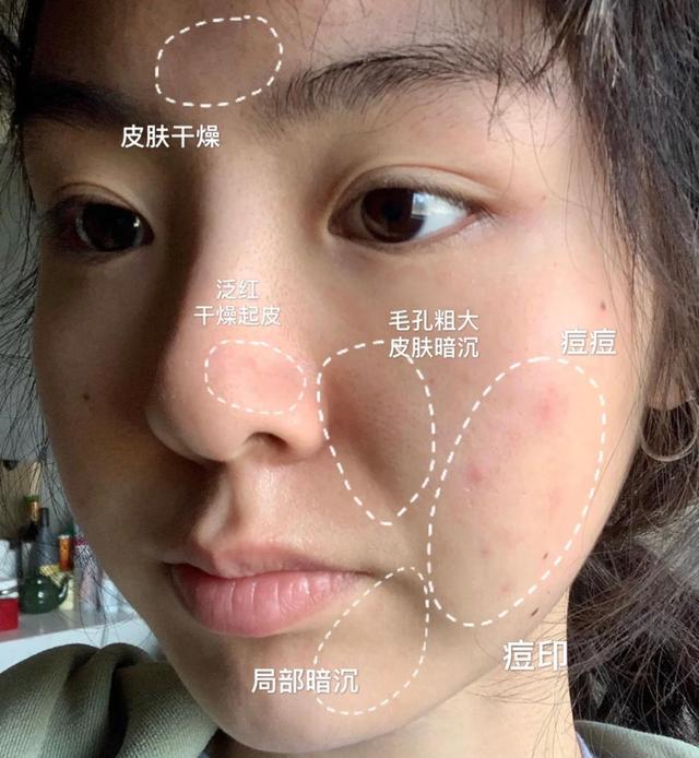 面膜多久敷一次效果才会比较好,面膜敷多长时间用完要不要洗脸了