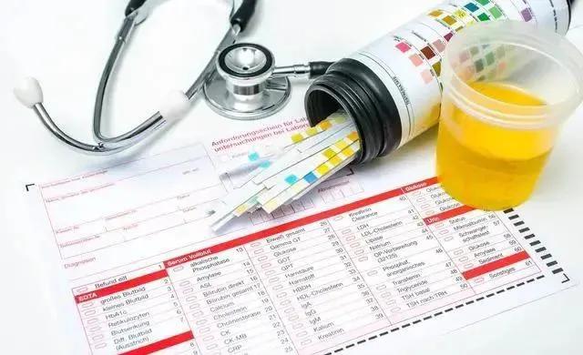 做尿常规前一定要知道这7件事，否则检查结果会出现很大误差