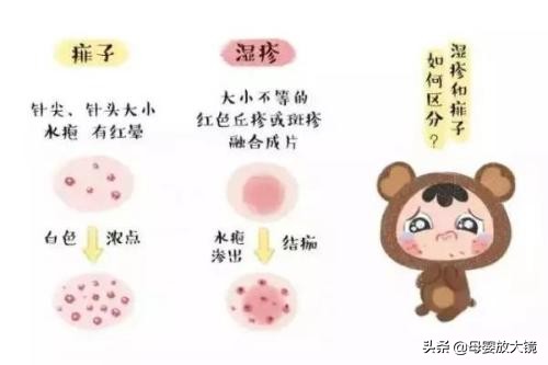 如何预防宝宝进幼儿园传染生病,新生儿宝宝如何护理常识