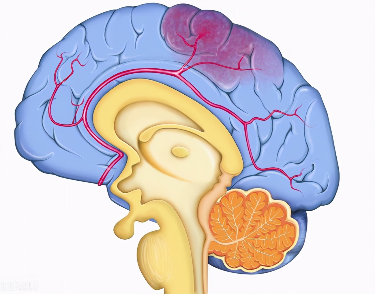 骨折病人想补钙吃骨头汤还是牛奶,骨折喝大骨头汤加快骨头愈合