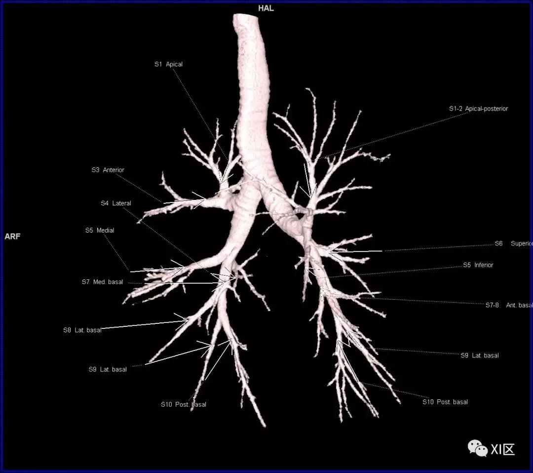 如此详细的肺部影像解剖，有点儿酷