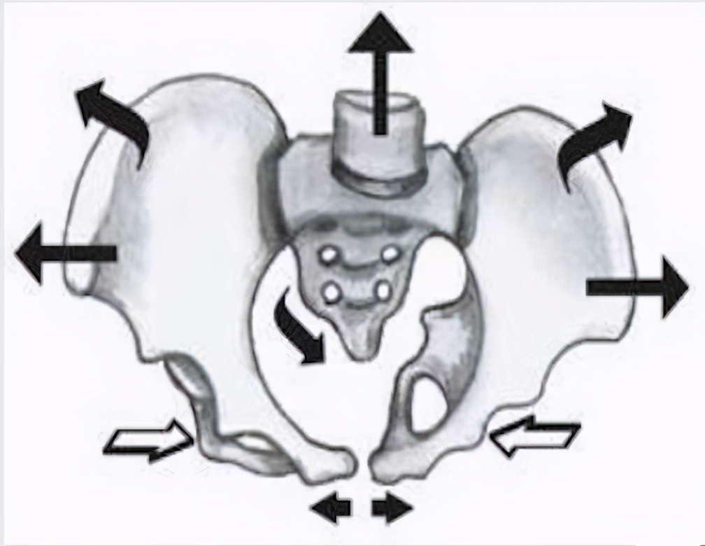 生宝宝选择剖腹产也需要做盆底肌修复，越早越好莫拖延
