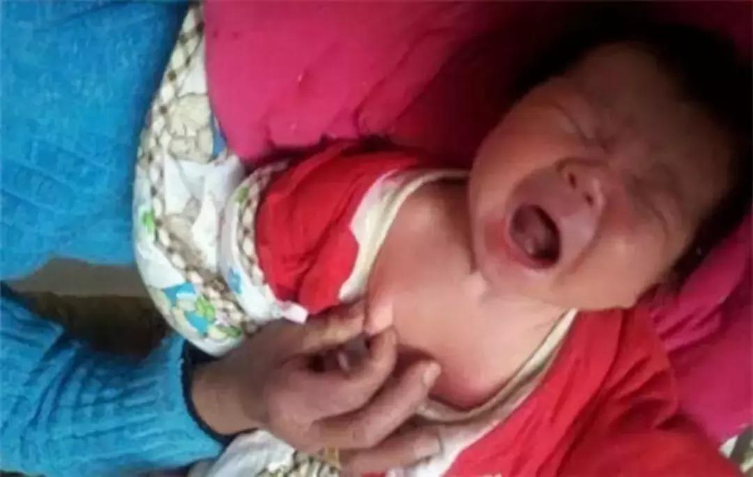 新生儿需要挤乳头？答：千万别，这会影响以后的发育