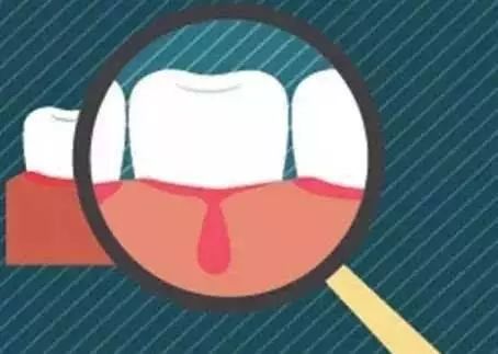 男朋友有牙周炎接吻会传染给我吗,情侣亲嘴会传染幽门螺旋杆菌吗