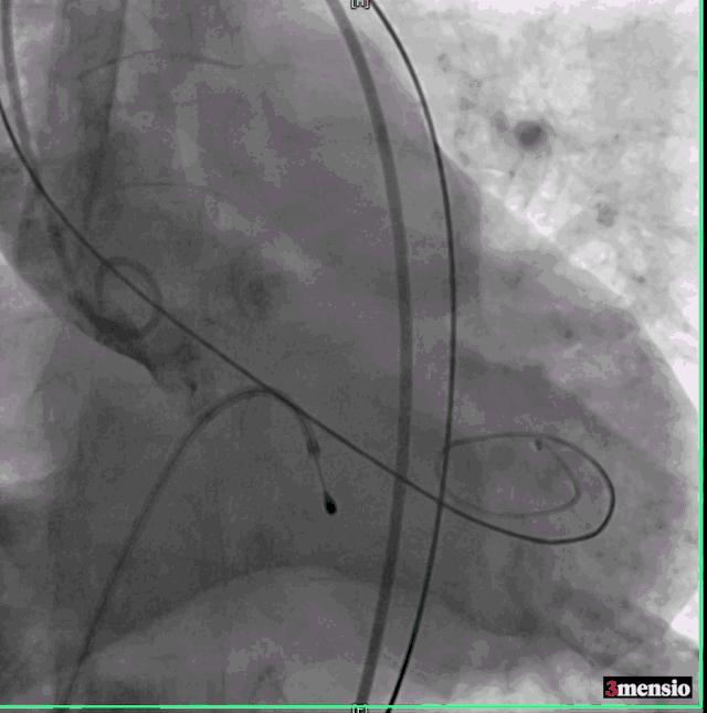 罗建方医生怎么样,罗建方教授