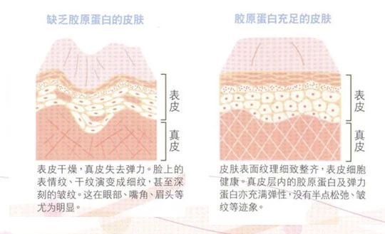 激光美白建议做吗,对激光还有哪些了解