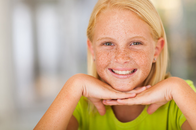 雀斑自己能慢慢消退吗,雀斑会自己消失