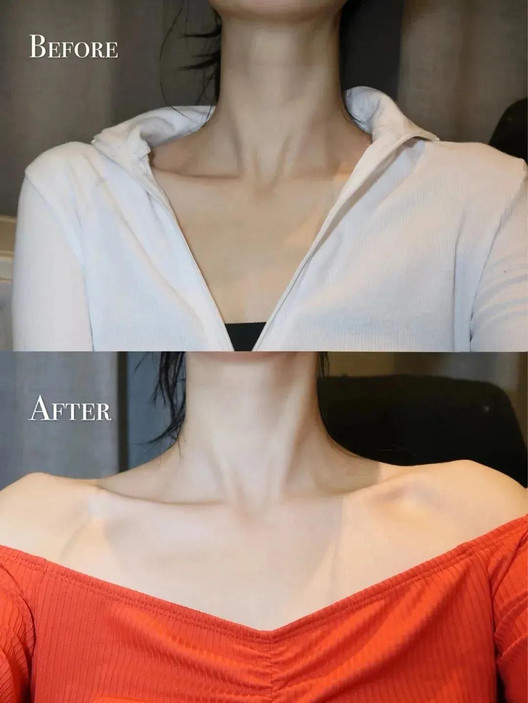 真牛！松弛老态的眼周，都被“马应龙”治住了