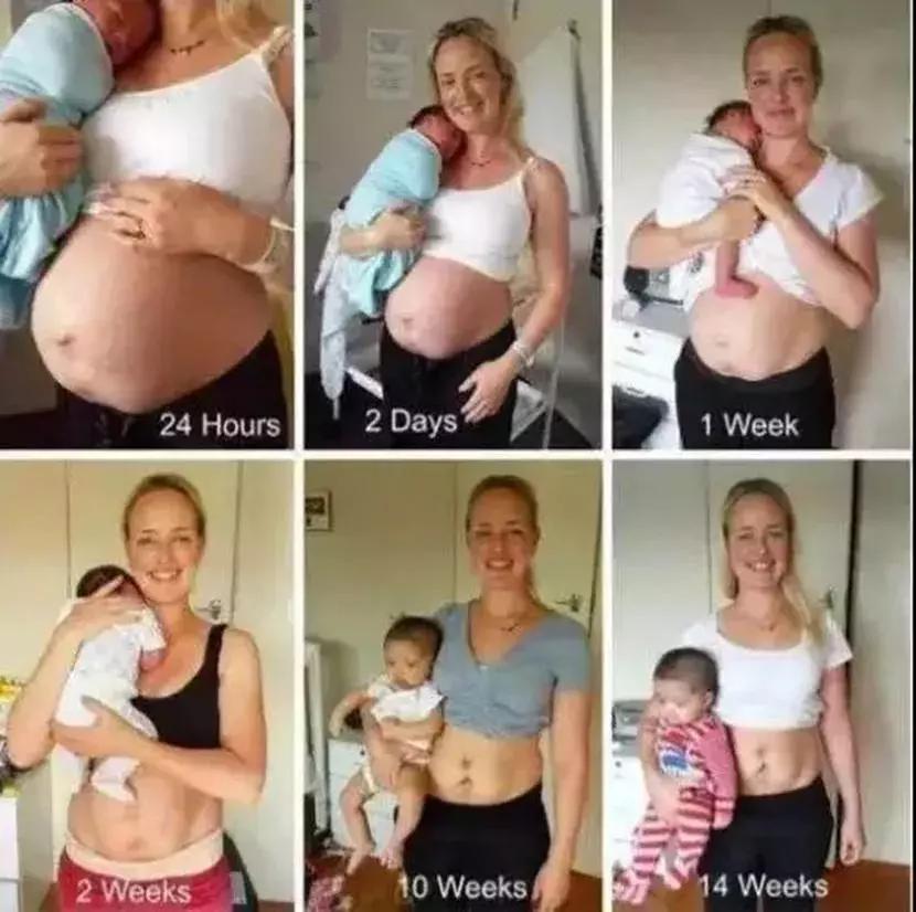 生娃后肚子凹下去,生完宝宝肚子大自己能恢复吗