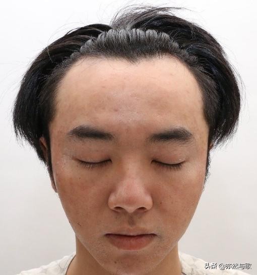 网友晒华晨宇私密视频，曝料其整容植发照，怒骂张碧晨是小三