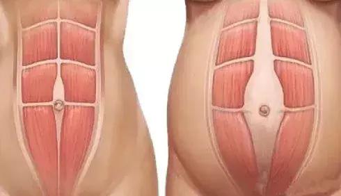 最好用的瘦腰神器 (瘦腰神器是真的有效果吗)