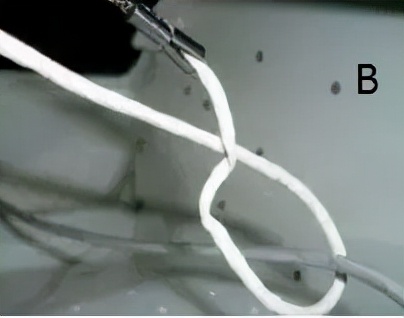 腹腔镜下打结的方法,腹腔镜推结器打结方法视频