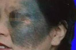 女人脸上有斑点是怎么回事,50岁女人脸上有斑点怎么消除