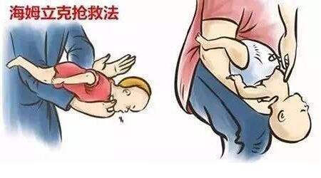 幼儿吞食不光滑异物该怎么办,宝宝吞食异物的处理办法