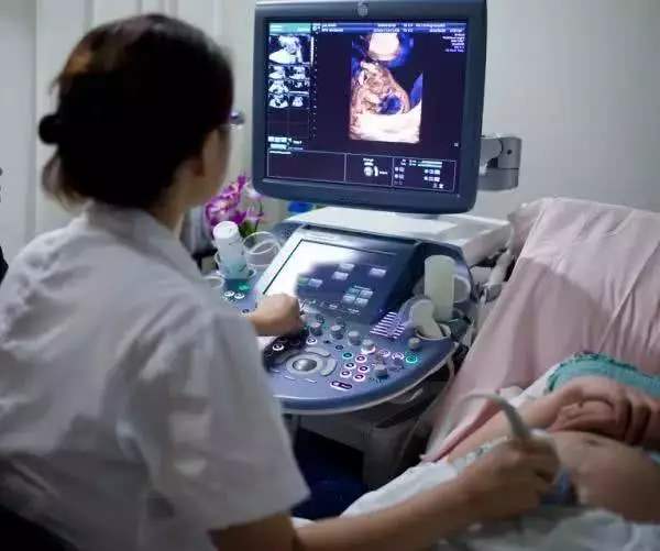 宝宝四维照片和生下来照片对比,四维照片所有宝宝都长得一样吗