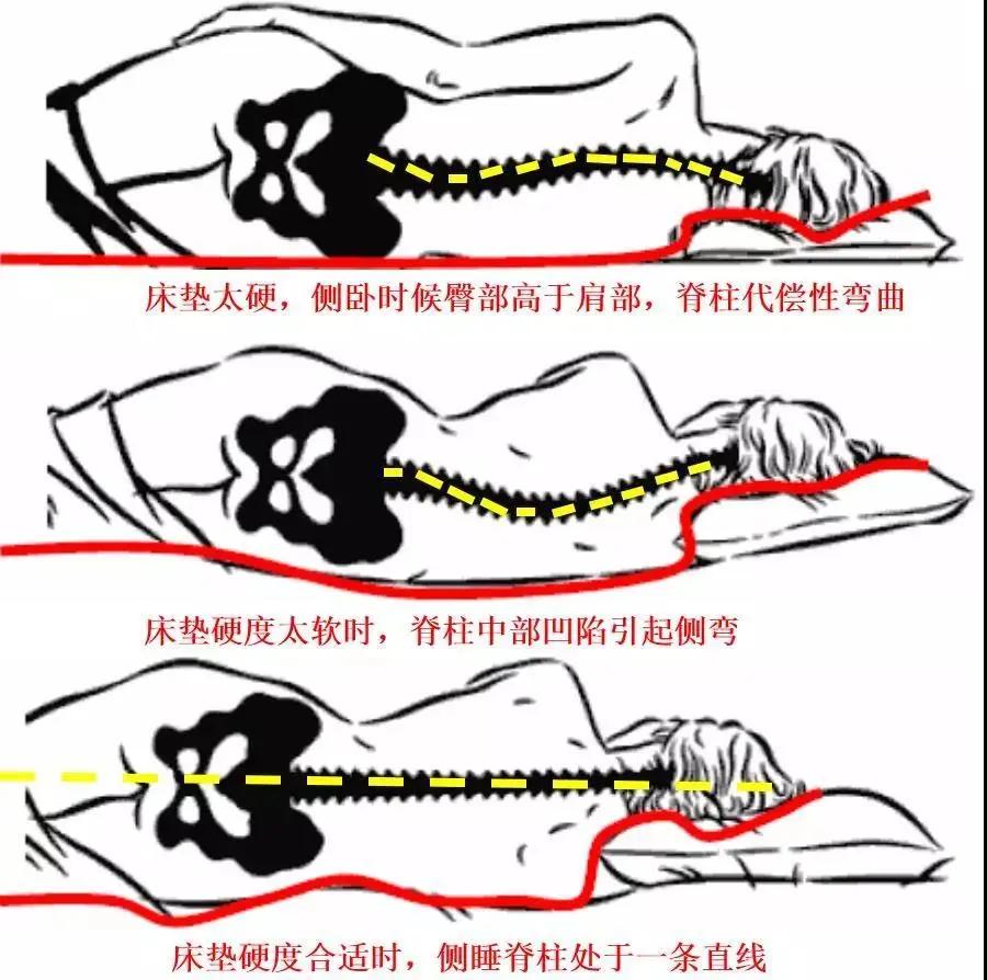 一招消除落枕,4个小妙招缓解落枕痛