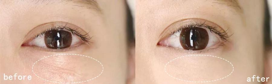 又好用又不贵的30岁以上的眼霜,25岁以上适合的平价眼霜