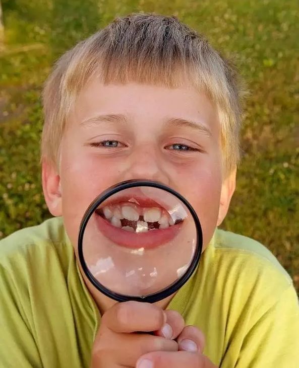 换牙两个门牙之间两毫米缝隙,儿童换牙两门牙中间缝隙大