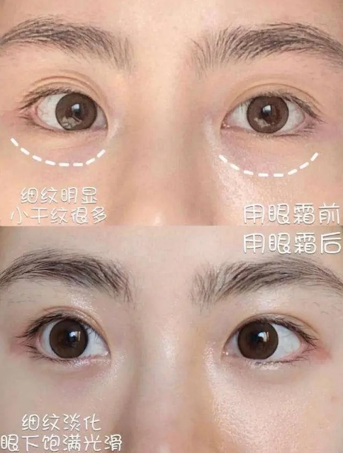 45岁紧致去细纹最好的眼霜排行榜,抗老去皱几款抗皱眼霜