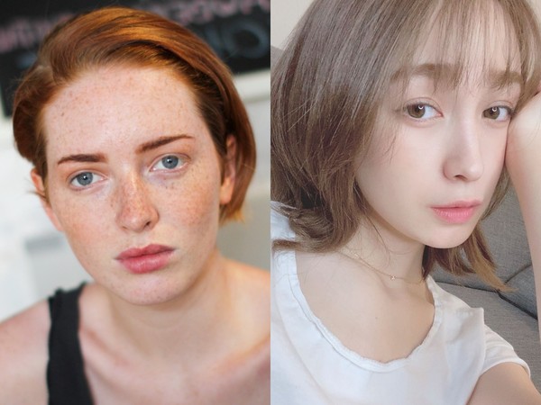 想真正祛斑怎么办,想去医院治斑