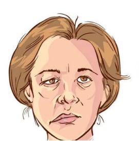 面瘫临床表现的科普视频,科普面瘫多久治疗效果最好