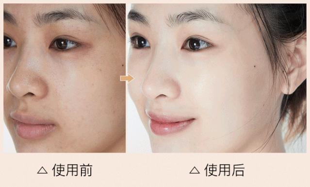 私信法国葡萄籽抗氧修护眼部精华,葡萄籽美白精华淡化皱纹吗