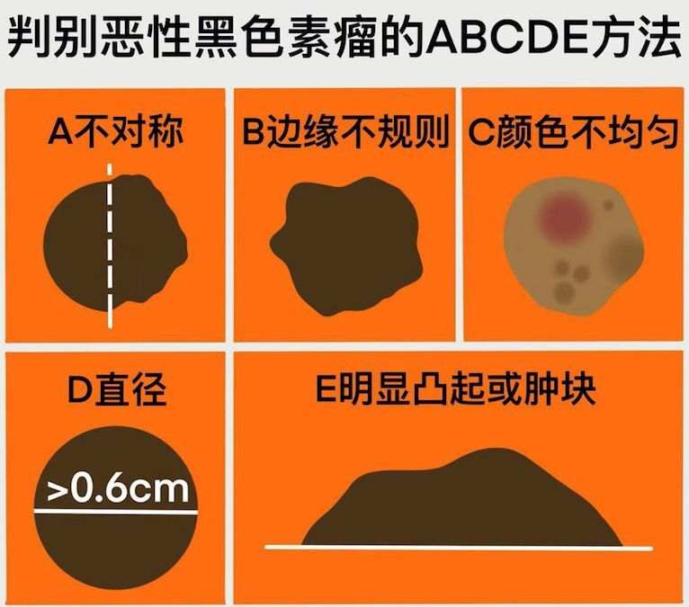 脸上多痣想祛除又怕留疤咋办,脸上切痣疤多久能消除