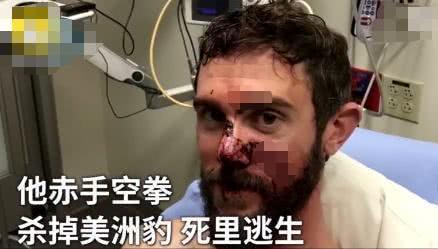 你这一胳膊肘下去,对方的头骨都可能会被干裂?硬核分析不容错过