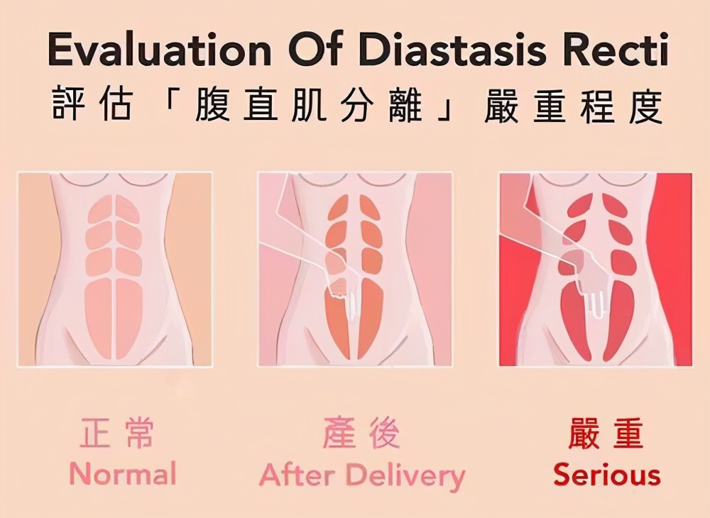 生孩子直接衰老11岁?产后衰老主要体现在哪些方面?如何应对?