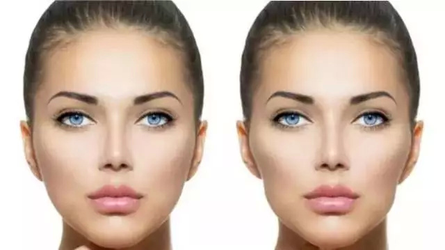 牙齿矫正导致颧骨突出,牙齿矫正感觉牙要掉了怎么办