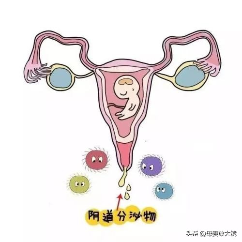 如何排除孕早期用药对胎儿的影响,孕早期有哪些症状需要及时就医