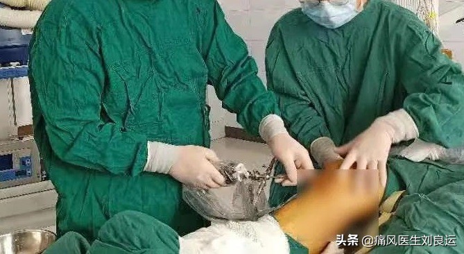 痛风发作怎么避免有痛风石,痛风长石头吗