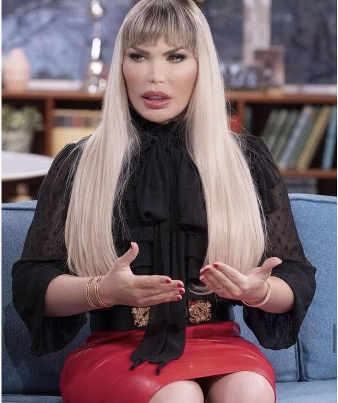 巴西男整容42次图片,巴西男模花数百万整容