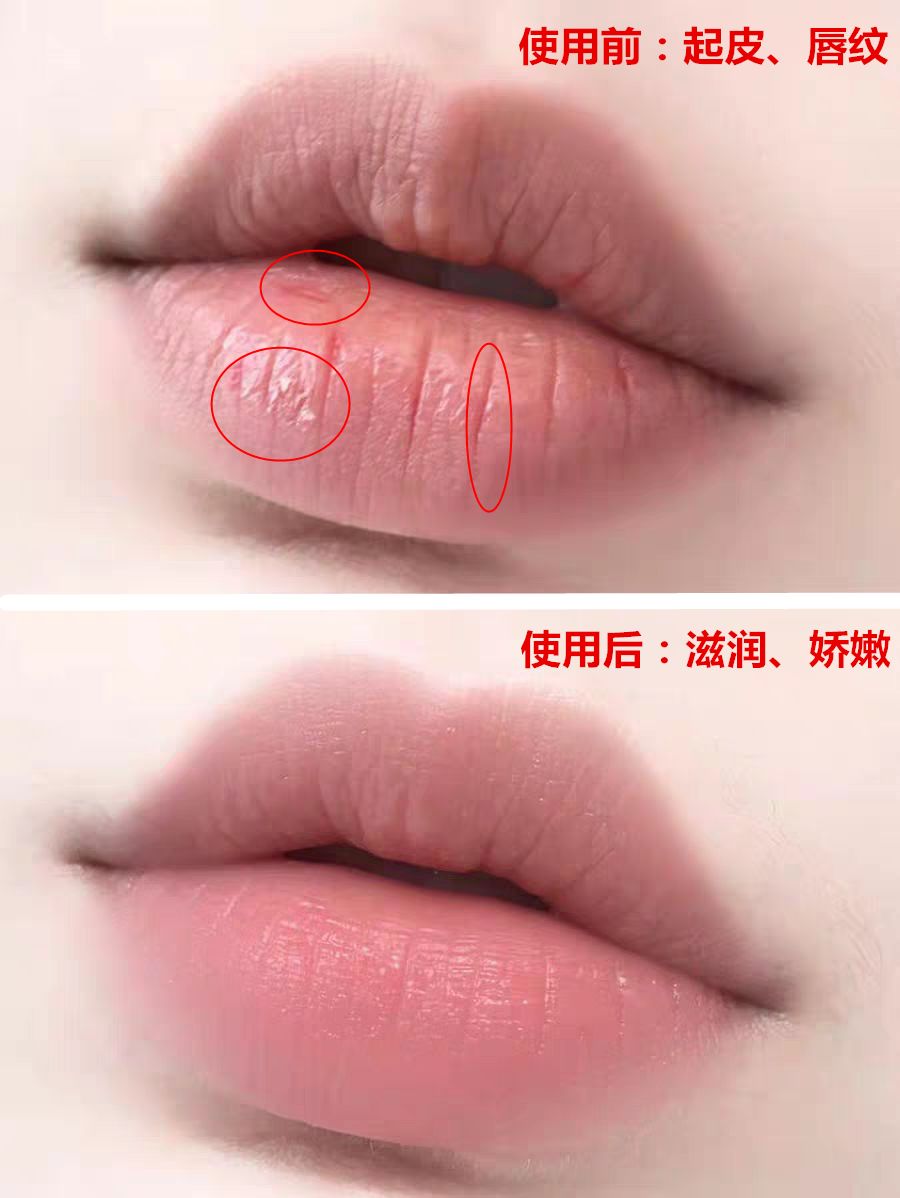 周冬雨唇形,周冬雨的脸高级吗