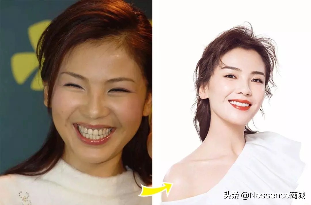 牙齿美白方法,牙齿美白去黄的最快方法