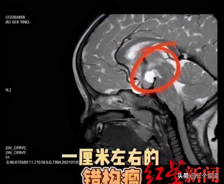 幼儿园小朋友长小胡子,幼儿园的孩子早熟