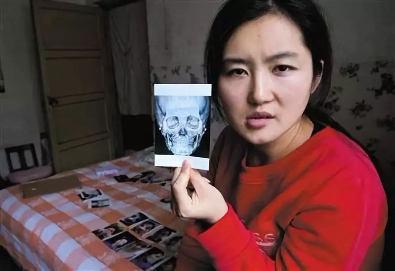 被整容毁掉女明星,被整容毁掉的中国女明星