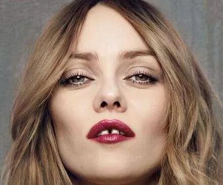 上火引起牙龈肿痛十大消炎药,牙龈肿痛吃了消炎药反而更严重了