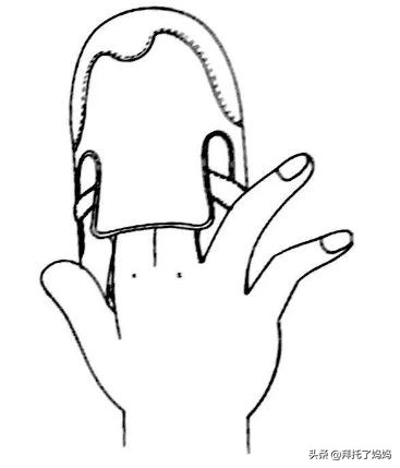 宝宝腿部弯曲不正常图片,宝宝腿畸形是因为什么