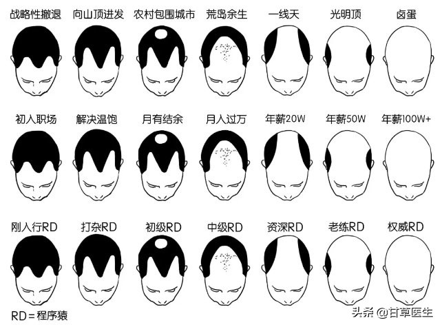 中医治脱发看什么科,中医谈脱发