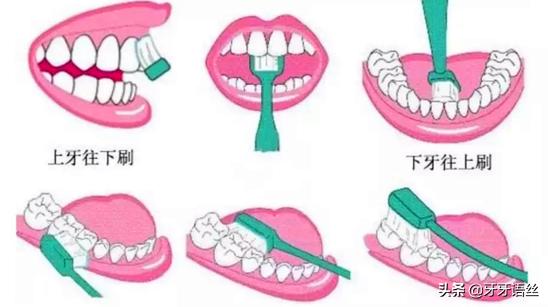 每逢节假日就牙痛?如何在节假日既能享受美餐又能健康口腔