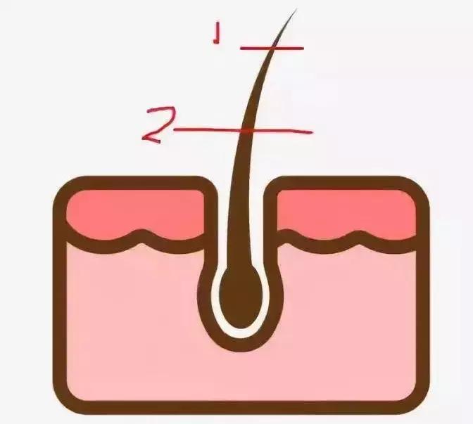 8种脱毛方法了解一下,5种最靠谱的脱毛方法