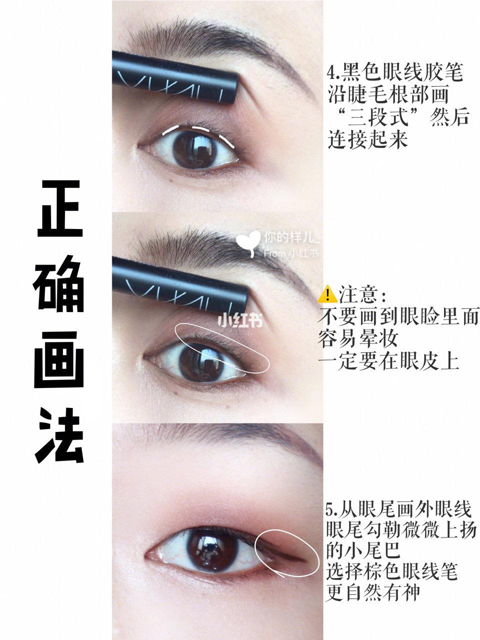 肿眼泡内双怎样贴出宽大双眼皮,肿眼泡内双眼皮怎么整形