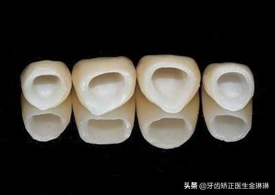 山东烤瓷牙什么牌子好,淄博市烤瓷牙价格