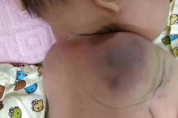 卡梅综合征说明什么,卡梅现象与卡梅综合征