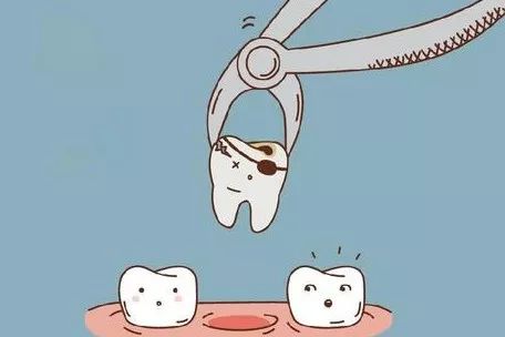 一分钟带你看牙齿矫正的全过程,最常见的牙齿矫正问题速度收藏