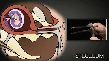 多次打胎真实案例,25岁女生接受多少次打胎
