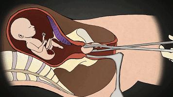 被孩子撞见你会怎么做,做好事被孩子撞见了怎么办