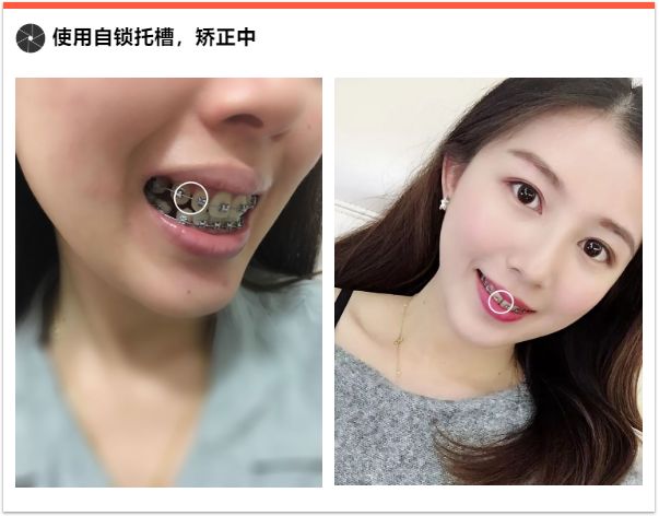 鍠滃ぇ鏅鏈夊暐浼樻儬,鍠滃ぇ鏅浼樻儬