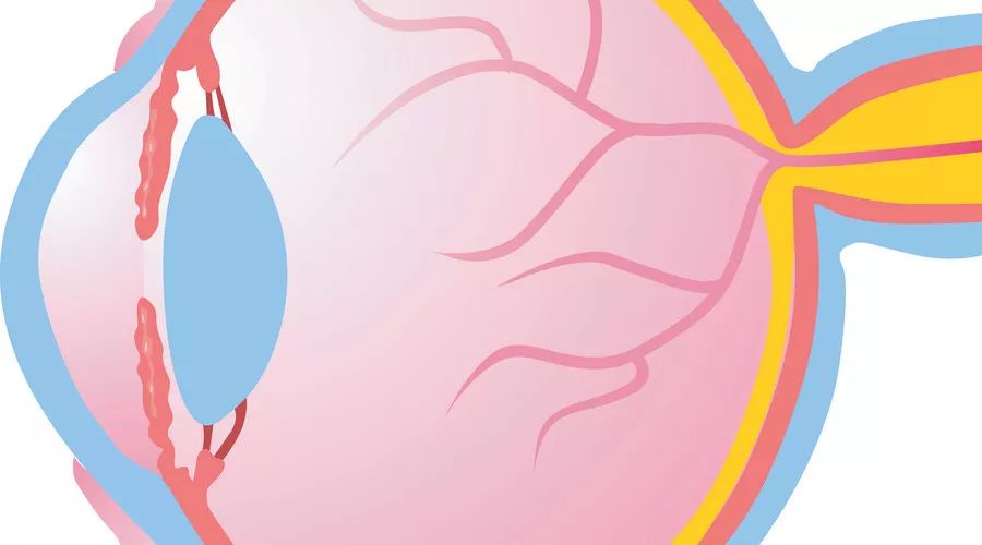 最新黑科技近视手术,黑科技近视治疗